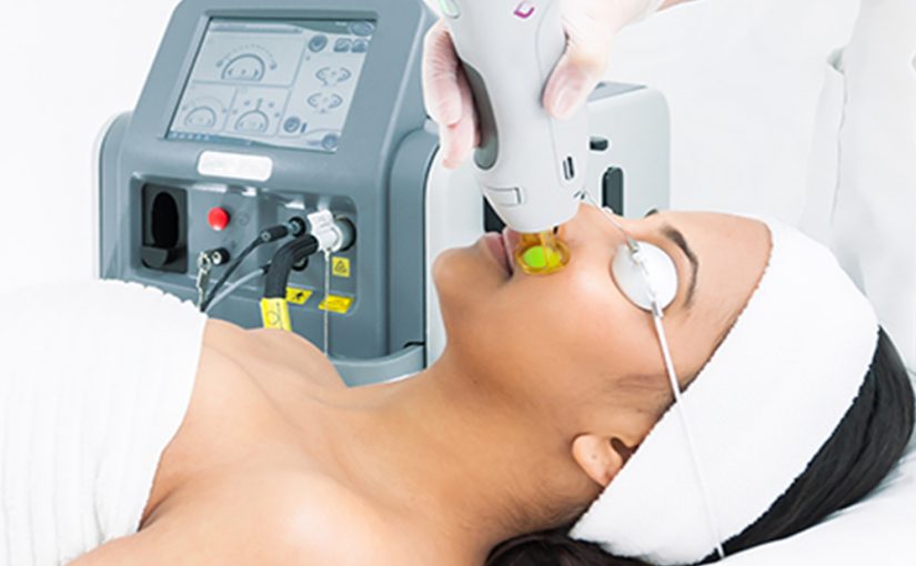 How To Choose The Best Laser Hair Removal Machines For Your Salon