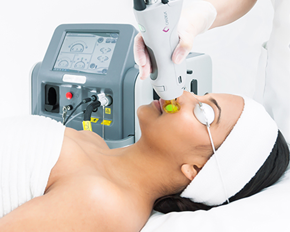 laser hair removal equipment