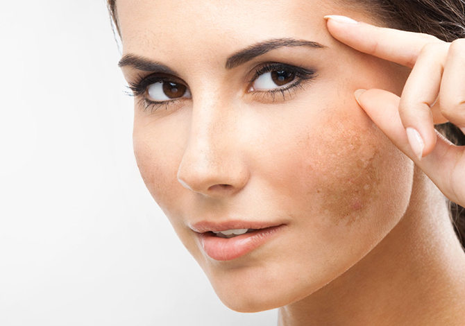 Buy Best Priced IPL and Laser Systems for Skin Rejuvenation from MedLaser USA