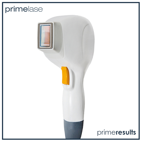 primelase best laser hair removal machine 15