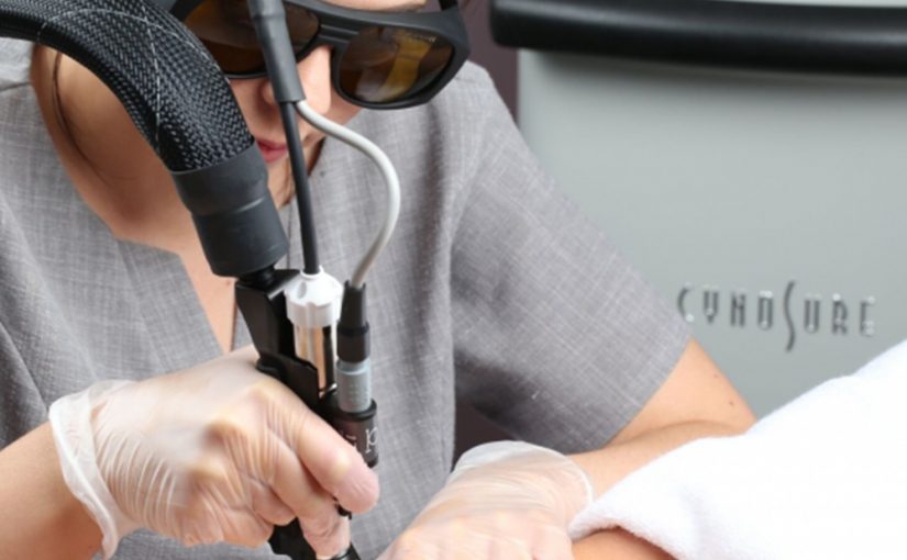 Focus on The Cynosure Laser Machines for Hair Removal Treatments